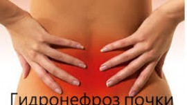 Диагноз при гидронефрозе